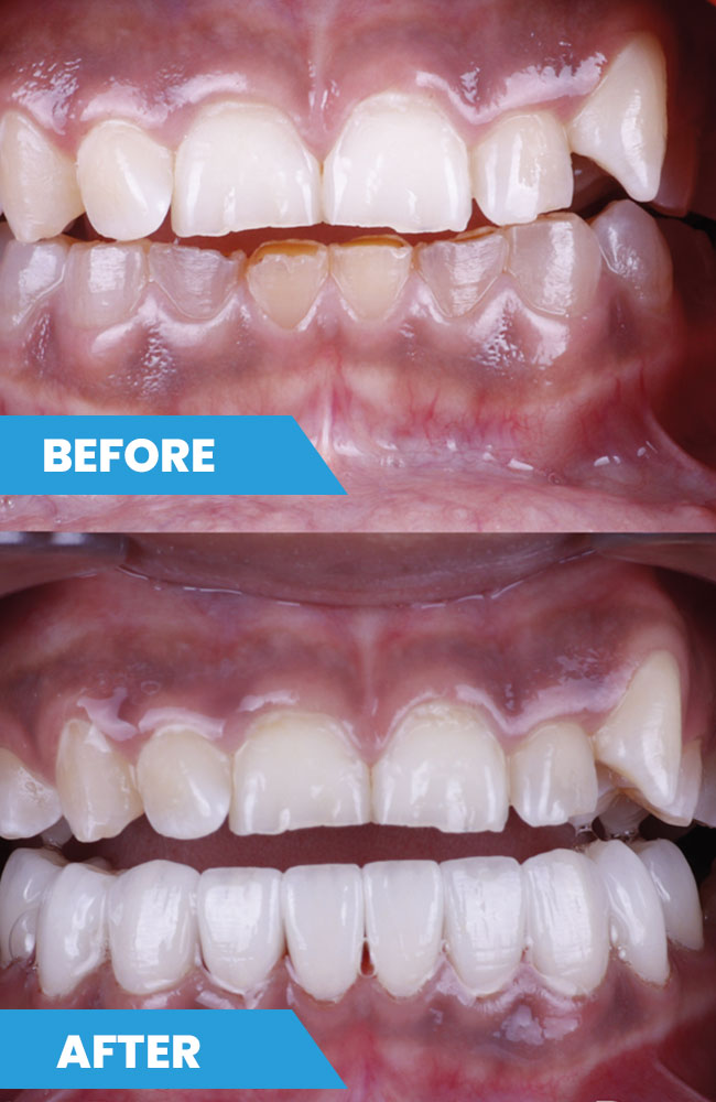 Before-and-after1