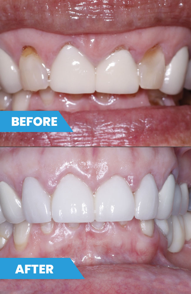 Before-and-after2