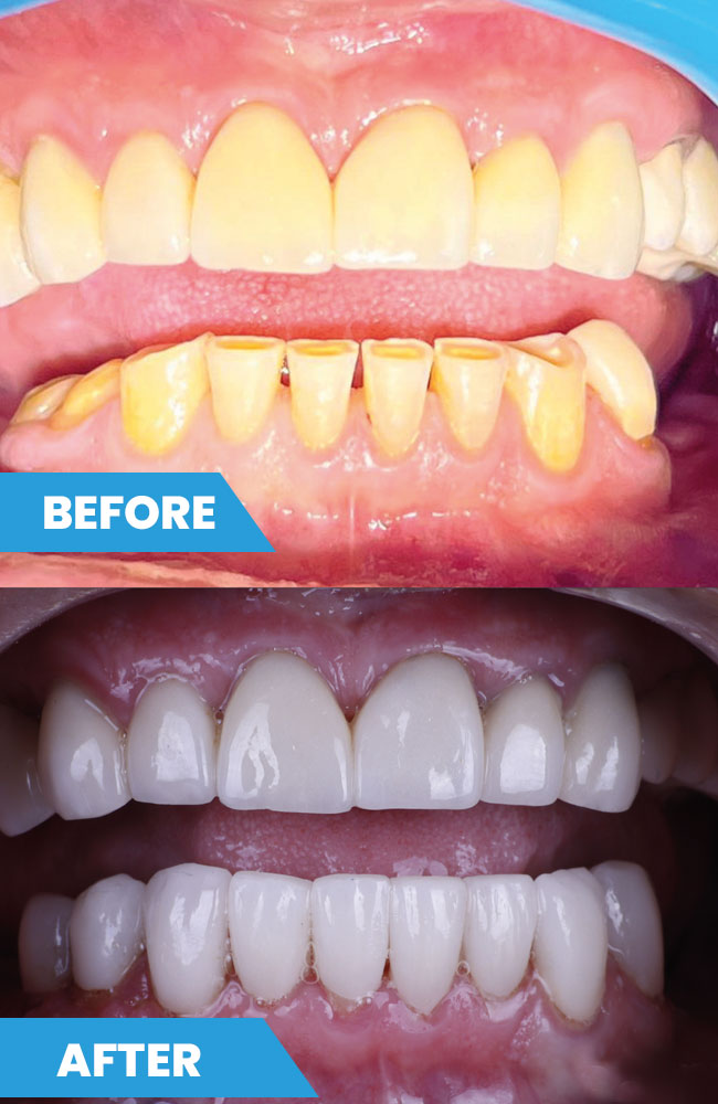 Before-and-after3