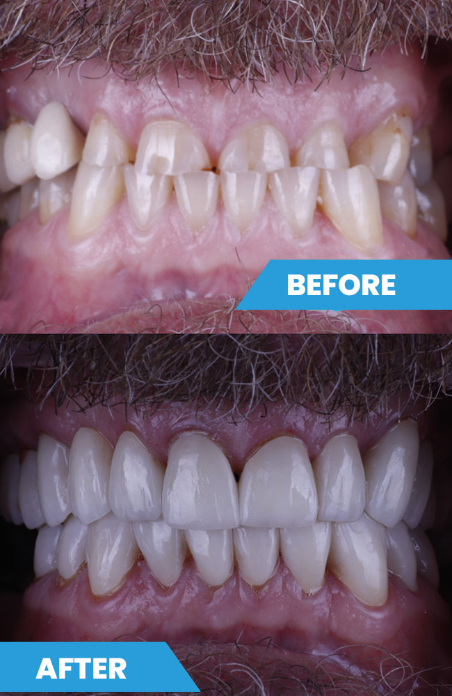 Before-and-after4