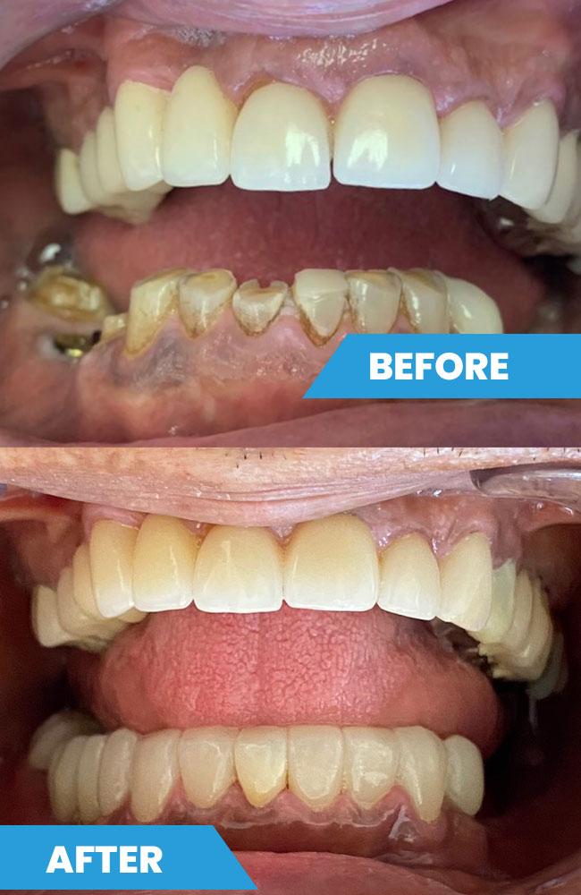 Before-and-after5
