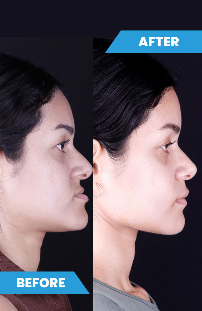 Before-and-after6